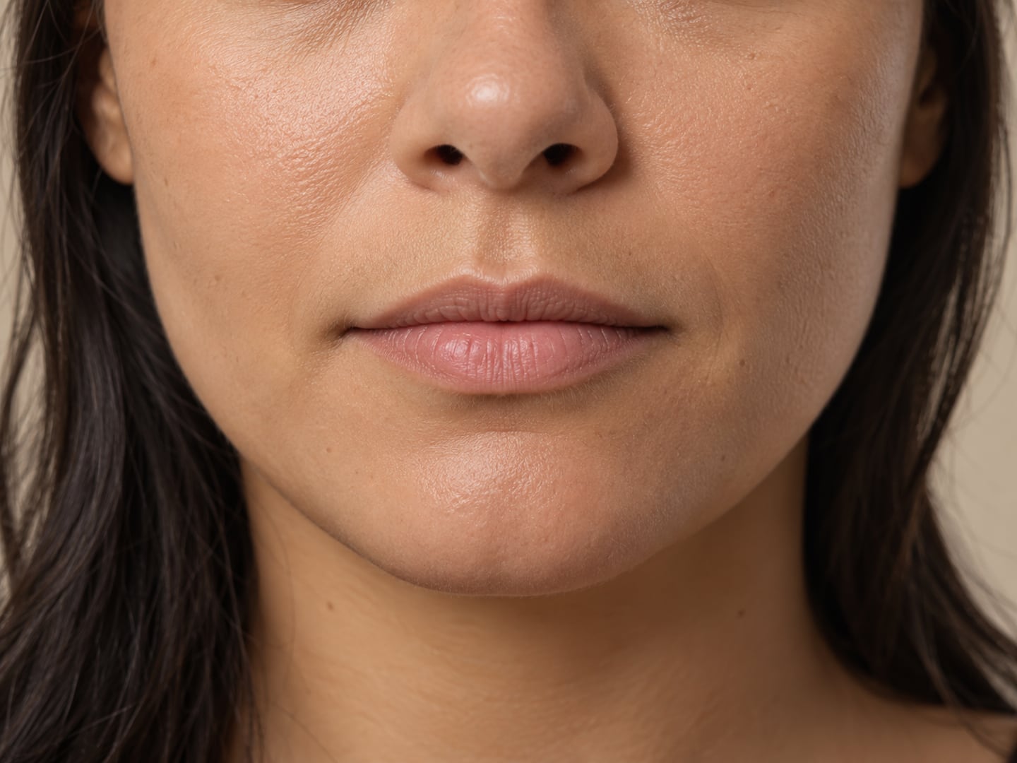 Preenchimento Labial — Antes